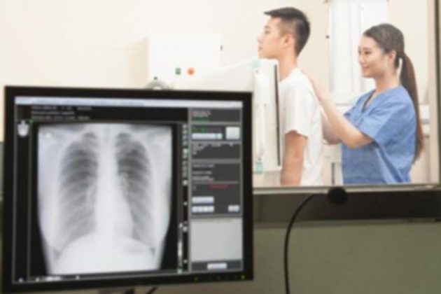 How Does an X-ray Machine Work? - Techicy